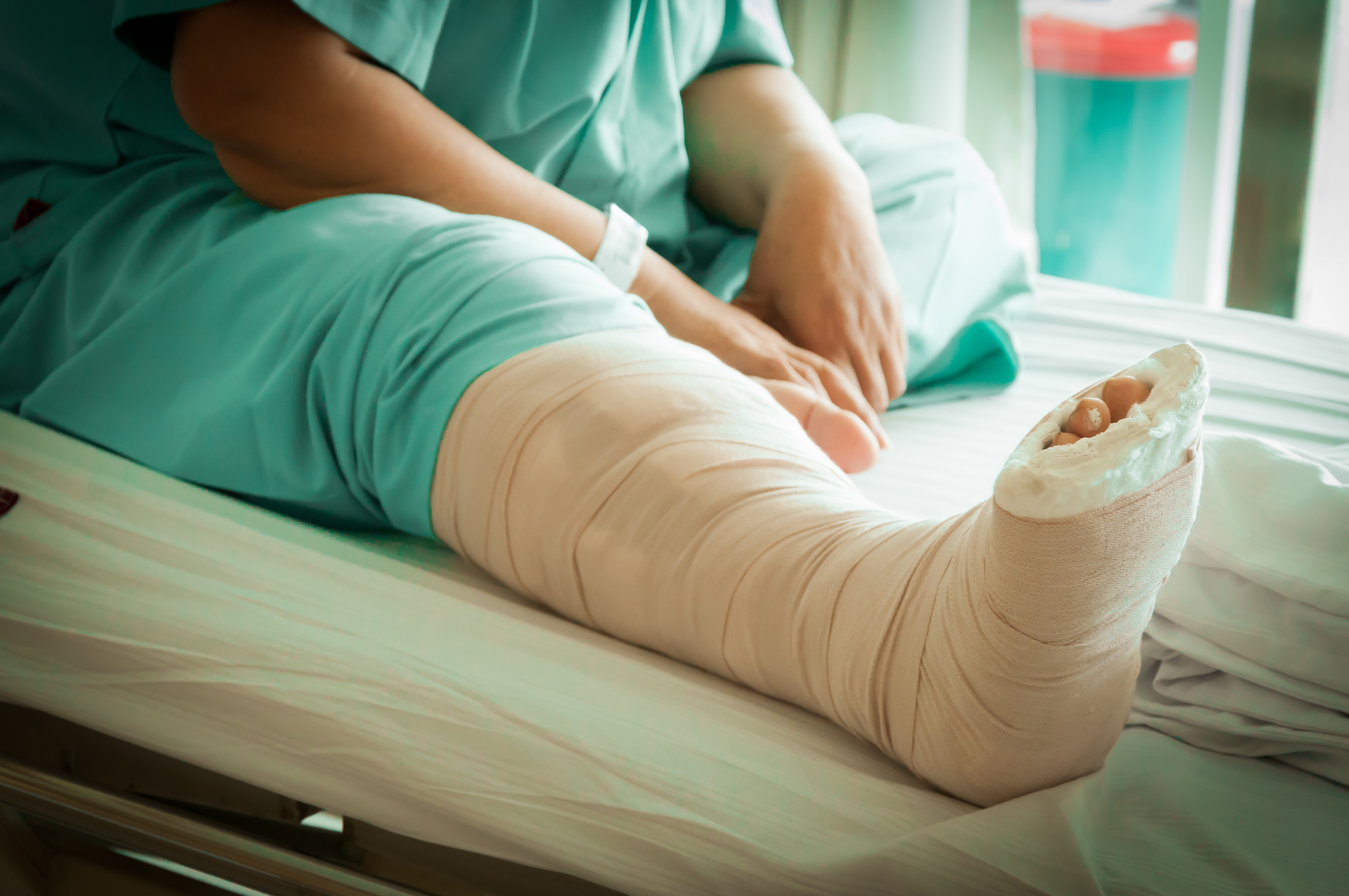 person in hospital bed with cast on leg