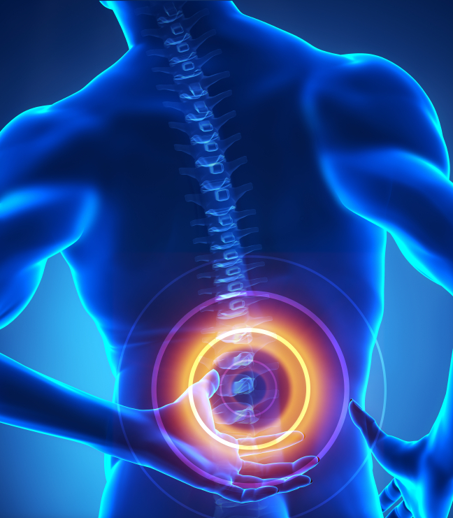 spinal cord injury image
