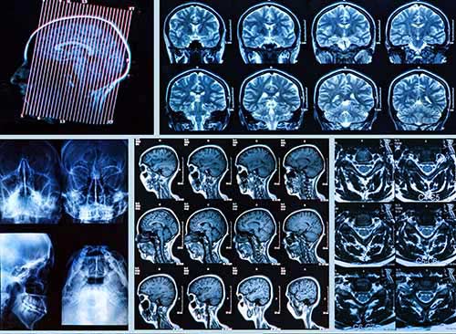 brain scans with many different angles